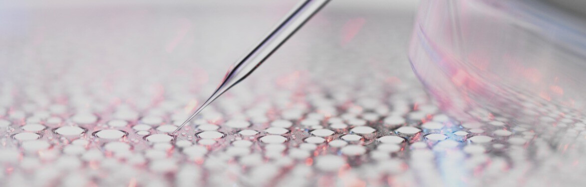 Eşsiz bilimsel yaklaşımımız olan ekobiyolojiyi keşfedin.